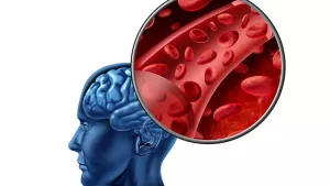 Ilustrační obrázek