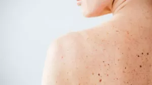 Ilustrační obrázek