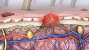 Ilustrační obrázek