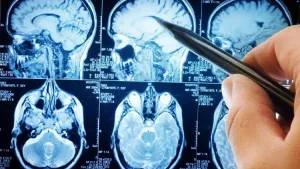 Ilustrační obrázek