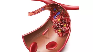 Ilustrační obrázek