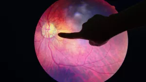 Ilustrační obrázek