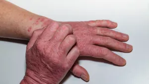 Ilustrační obrázek