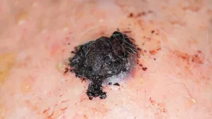 Ilustrační obrázek