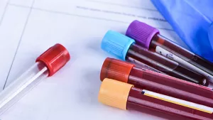 Ilustrační obrázek