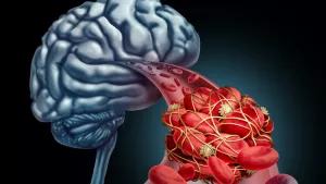 Ilustrační obrázek