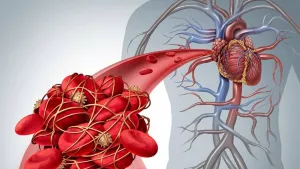 Ilustrační obrázek