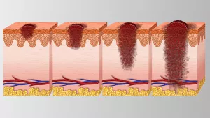 Ilustrační obrázek