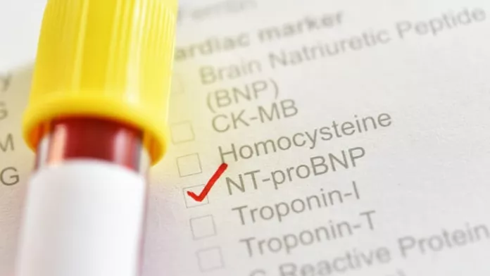 Ilustrační obrázek