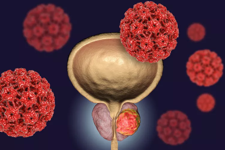 Ilustrační obrázek