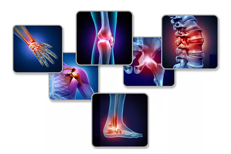 Ilustrační obrázek