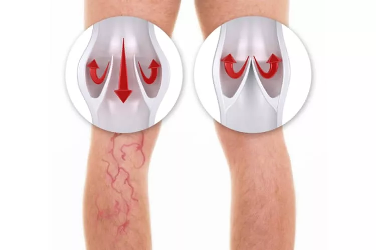 Ilustrační obrázek