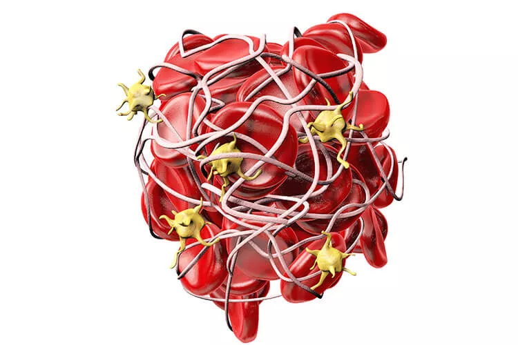 Ilustrační obrázek