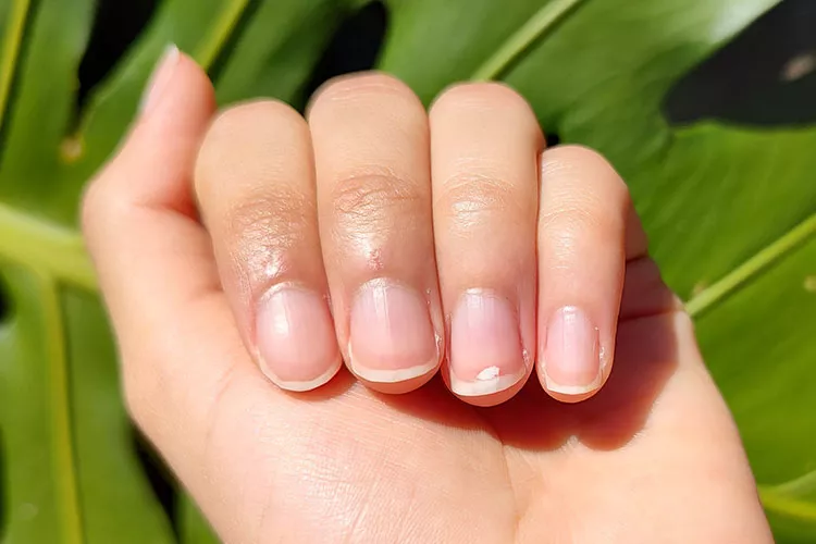 Ilustrační obrázek