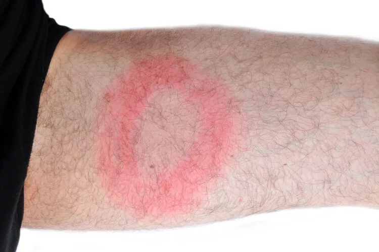 Ilustrační obrázek