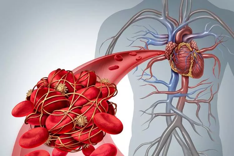 Ilustrační obrázek