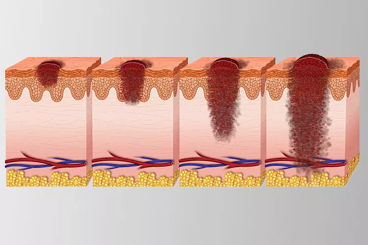 Ilustrační obrázek